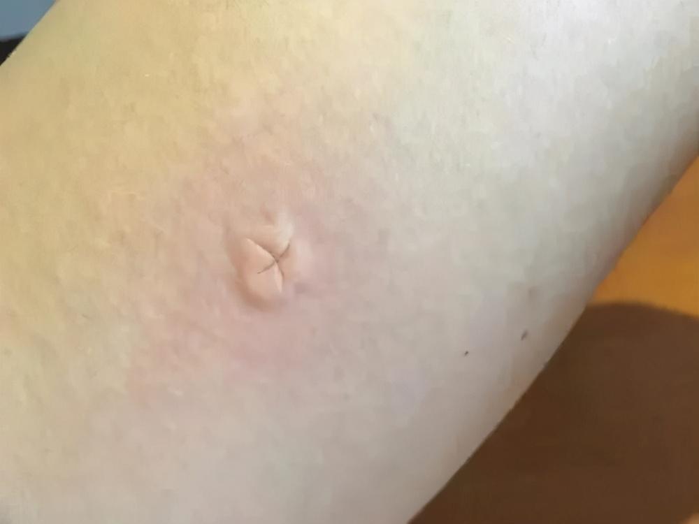 排名第一的灭蚊神器用法解析