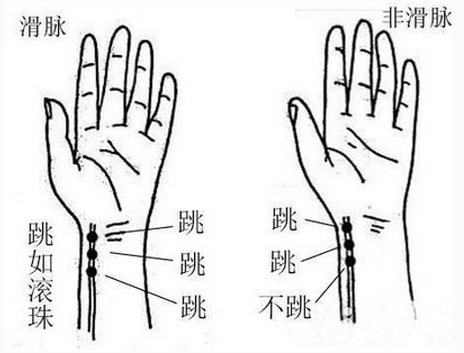 女中医把脉图片，传承与现代的交融