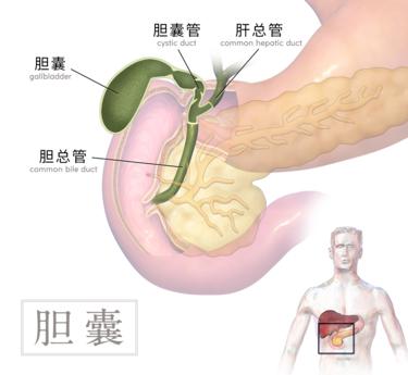 警钟长鸣，男子半年不吃早饭患胆结石，疼痛打滚警示健康