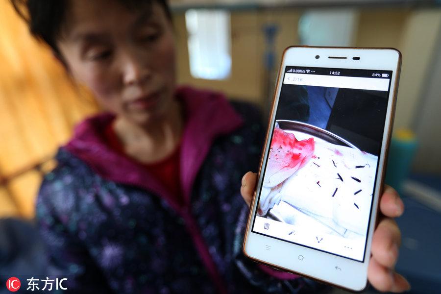 儿童筷子插鼻子能伤到哪？——深度解析儿童安全隐患