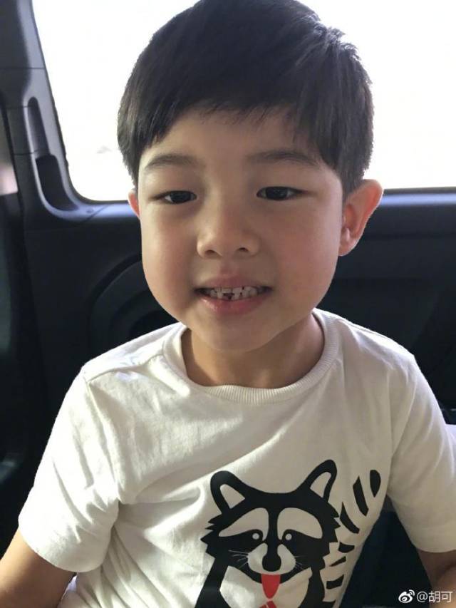 沙溢牙齿真相揭秘，传闻背后的真相探究