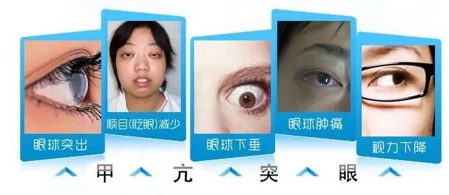 甲亢真的那么可怕吗？