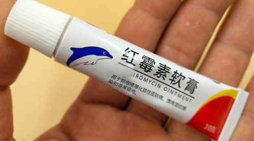 重庆街头偶遇甲亢哥遭遇尴尬塞痔疮膏事件