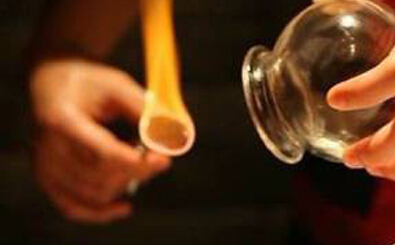 拔罐死人的新闻背后的深度解析