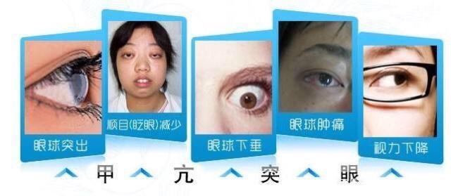 甲亢女孩难结婚？理解与支持是克服困境的关键