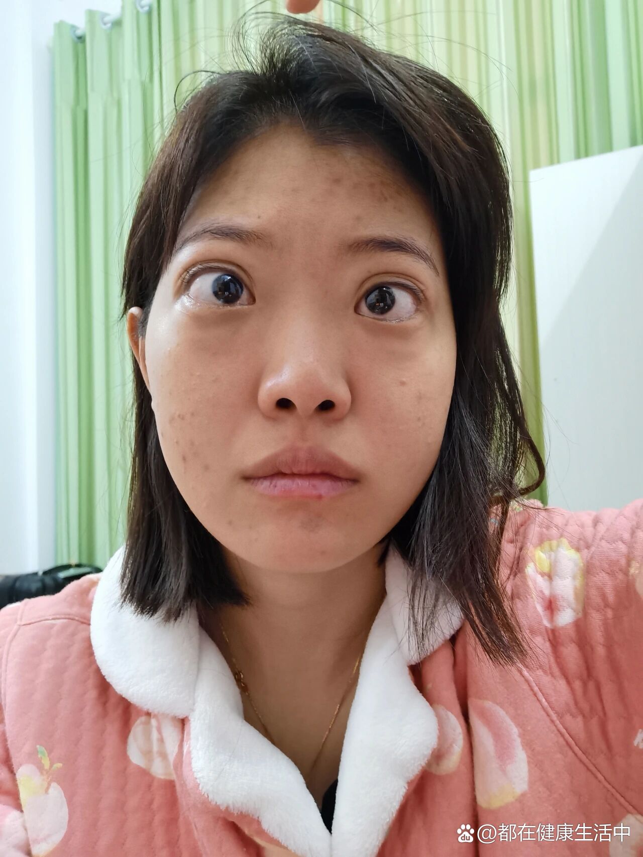 甲亢女孩难结婚？理解与支持是克服困境的关键
