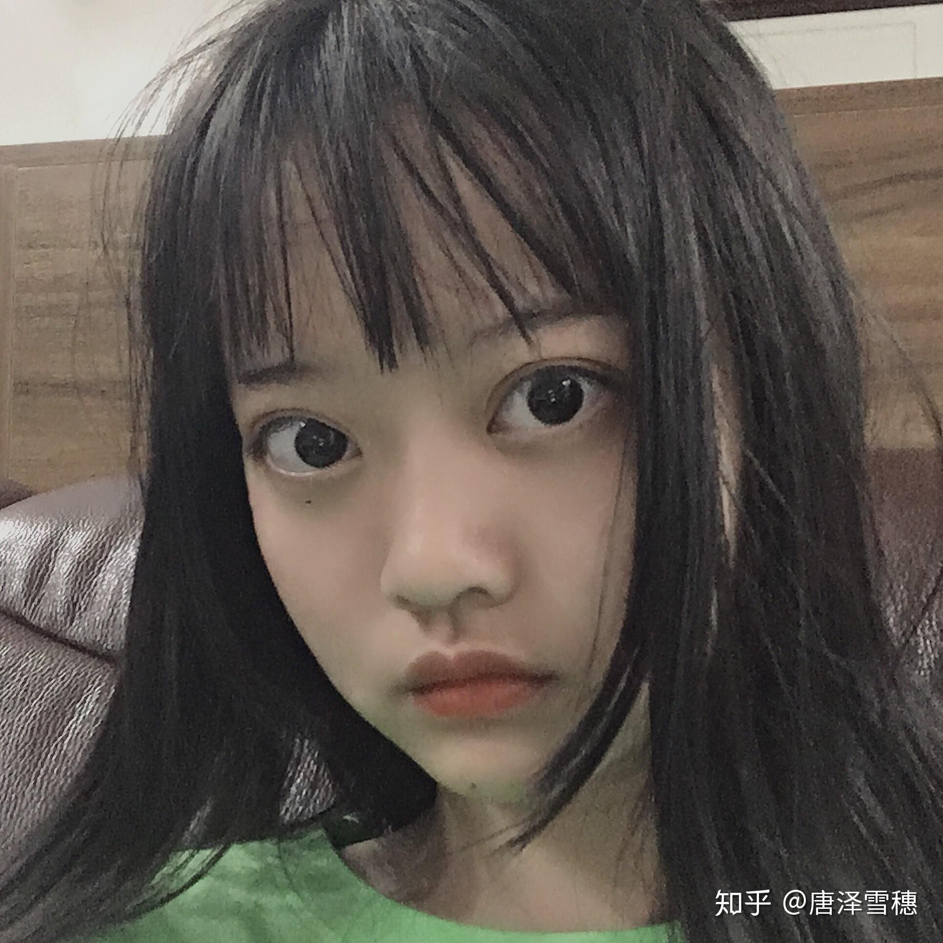 甲亢女孩能否找到好男朋友？