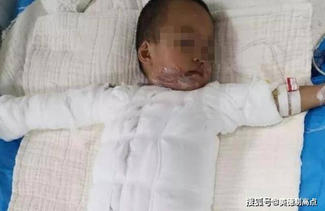 两岁幼童遭遇烧伤事件，婆婆对儿媳下跪，自责与愧疚交织