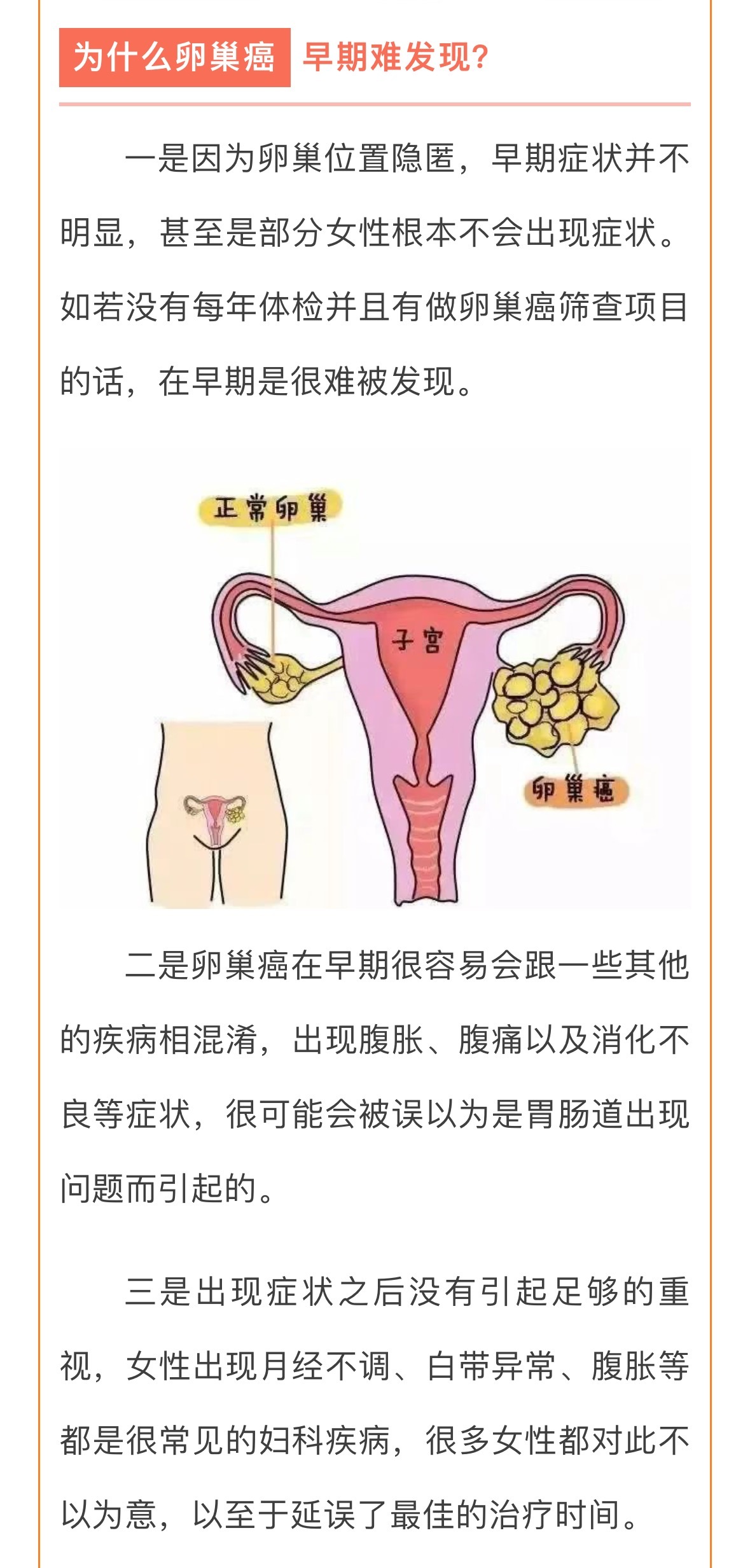 女子每年体检竟突然查出卵巢癌晚期，警惕与反思