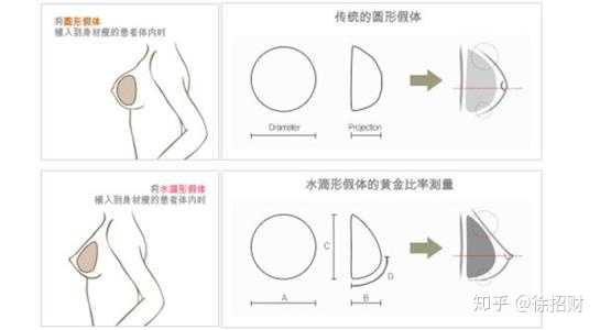 隆胸后的华丽转变，四个胸的时尚新纪元