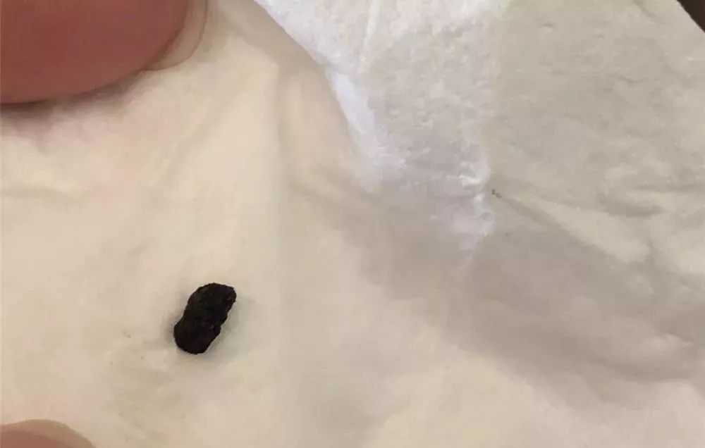 快递上沾有老鼠屎怎么办？全面解析应对方案