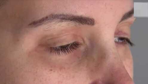 盲人眼球缺失办卡遭遇，社会关注与反思
