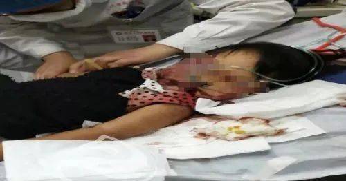 温州一母亲失手打死女儿事件曝光，警方介入调查