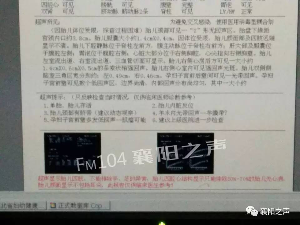 宝宝心肝脾全长反了，深度解析罕见病症与家庭应对策略