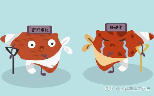 肝纤维化，一种疾病，其严重性如何？