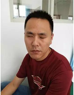 男子吹一夜空调竟引发面瘫，夏日如何科学使用空调？