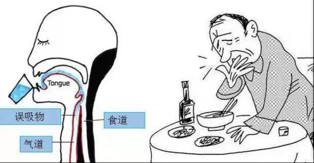 误吞的症状，识别与处理