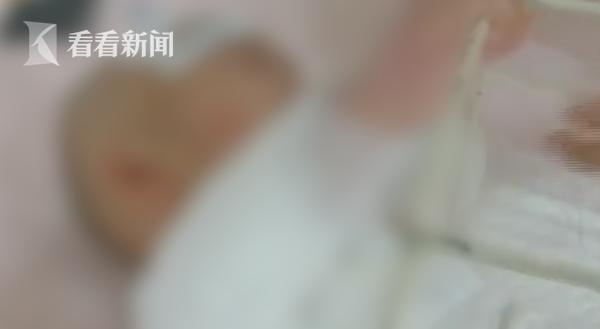 逆境中的绽放，全身85%烧伤女孩结婚了