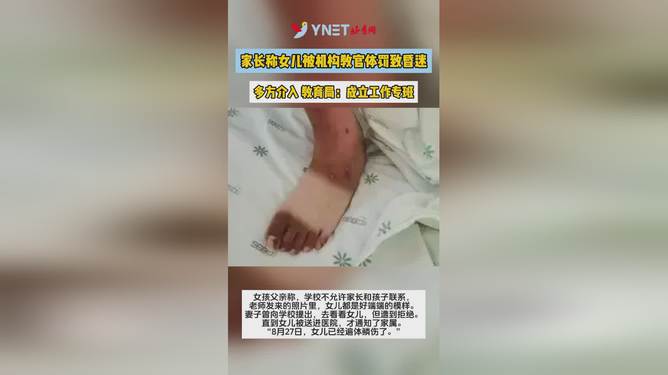 被教官体罚致换肾事件深度解析