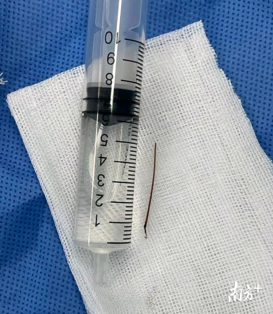 被注射器扎过的皮肤什么样